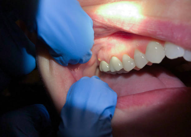 Best Same-Day Emergency Dentist in Bradner, OH