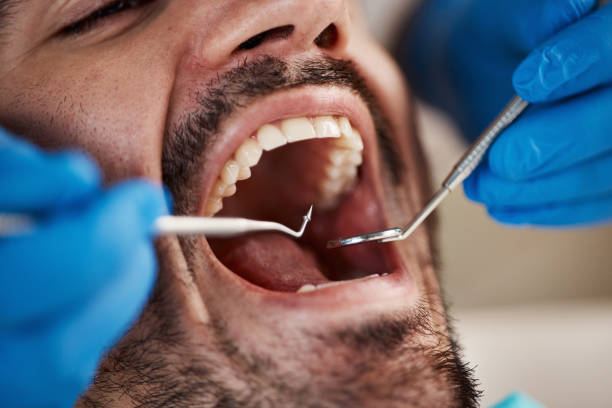 Best Walk-In Emergency Dentist in Bradner, OH